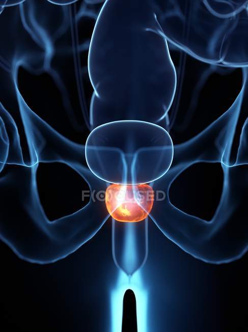 Prostata infiammata nel corpo maschile astratto, illustrazione digitale . — Foto stock