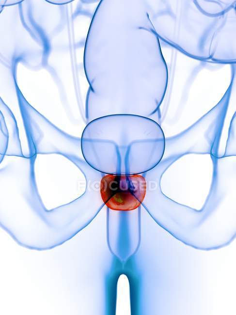Prostata infiammata nel corpo maschile astratto, illustrazione digitale . — Foto stock