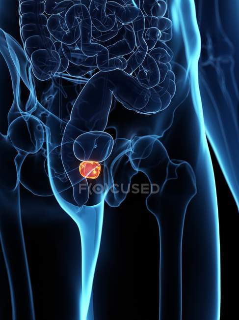 Inflamed prostate in abstract male body, digital illustration. — Stock Photo