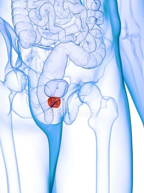 Prostata inflamada en cuerpo masculino abstracto, ilustración digital . - foto de stock