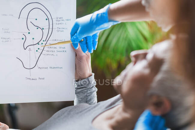 Aprendizaje de los pacientes sobre los puntos de oído en el tratamiento de auriculoterapia . - foto de stock