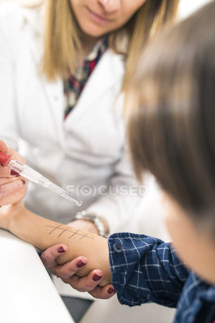 Médico feminino realizando teste de picada de pele de alergia no braço do menino . — Fotografia de Stock