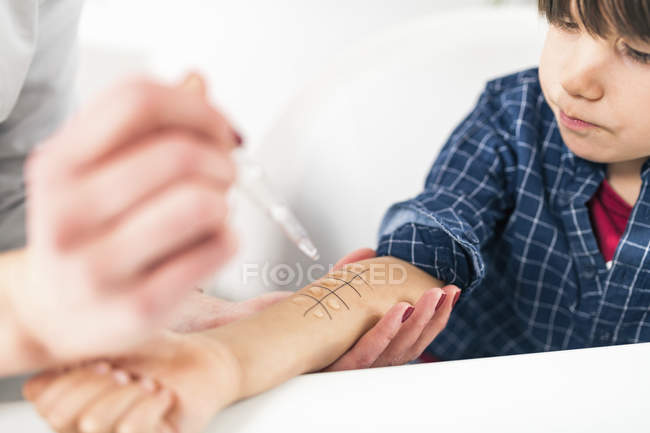 Close-up of immunologist performing skin prick allergy testing on boy. — Stock Photo