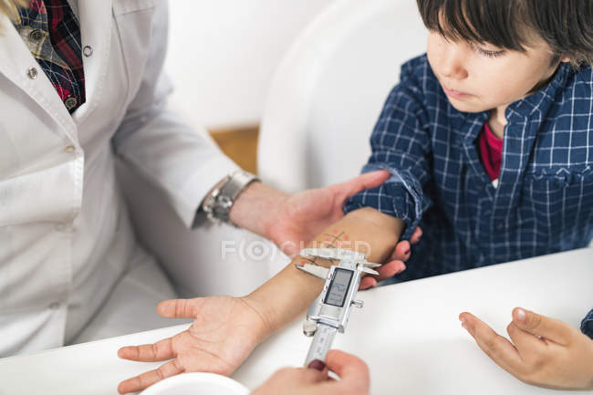 Female doctor measuring with calipers allergic reaction during skin prick test. — Stock Photo