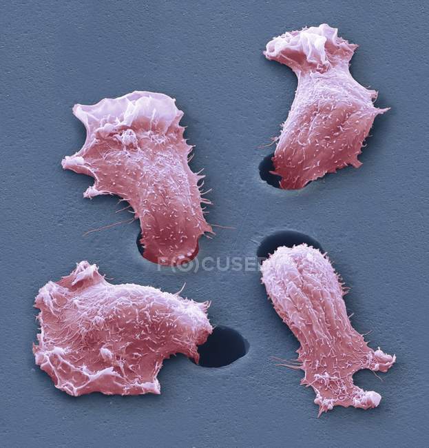 Цветной сканирующий электронный микрограф раковых клеток, мигрирующих вниз поры
. — стоковое фото
