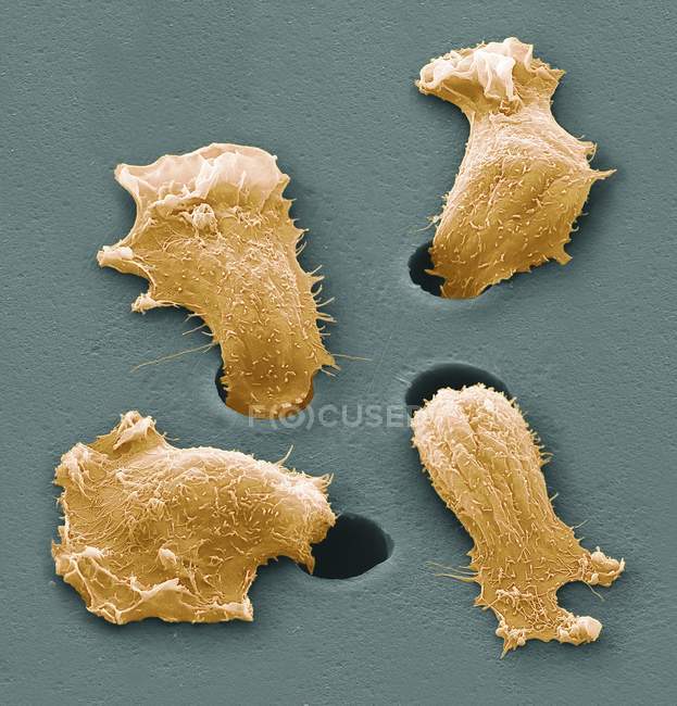 Micrographie électronique à balayage coloré des cellules cancéreuses qui migrent vers les pores
. — Photo de stock