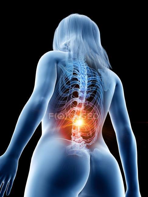 Abstrakter weiblicher Körper mit Rückenschmerzen, konzeptionelle digitale Illustration. — Stockfoto