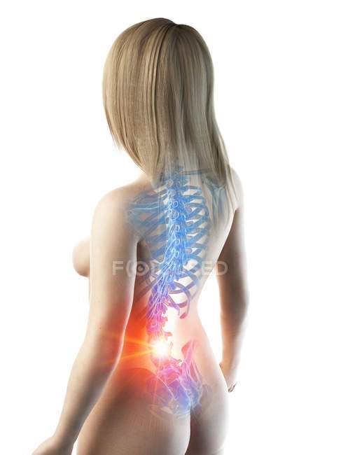 Cuerpo femenino abstracto con dolor de espalda, ilustración digital conceptual
. - foto de stock