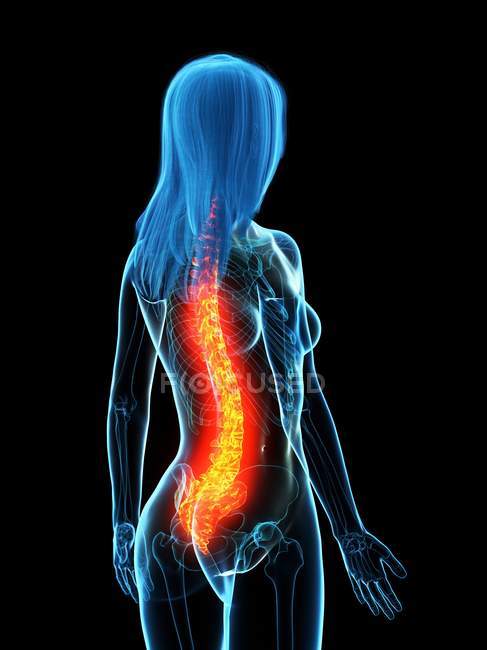 Corpo feminino abstrato com dor nas costas, ilustração digital conceitual . — Fotografia de Stock