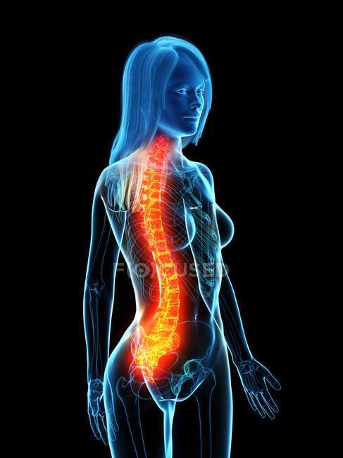 Абстрактне жіноче тіло з болем у спині, концептуальна цифрова ілюстрація . — стокове фото