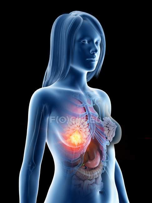 Жіноче абстрактне тіло з сяючим раком молочної залози, концептуальна комп'ютерна ілюстрація . — стокове фото