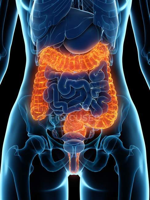 Corpo femminile con colon malato, illustrazione digitale . — Foto stock