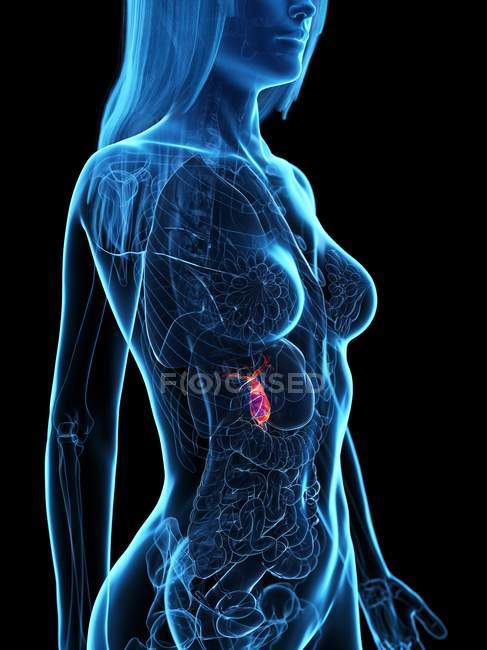Bexiga biliar doente em modelo de corpo feminino transparente, ilustração conceitual . — Fotografia de Stock