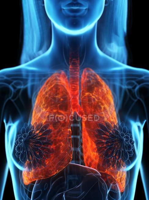 Хворобливі легені в прозорому жіночому тілі на чорному тлі.. — стокове фото