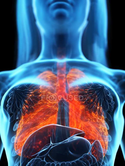 Poumons malades dans un corps féminin transparent sur fond noir, illustration par ordinateur . — Photo de stock