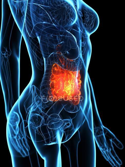 Malato intestino tenue nel corpo femminile silhouette trasparente su sfondo nero, illustrazione digitale . — Foto stock