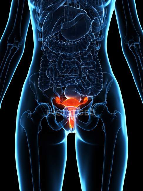 L'utérus malade dans le corps féminin, illustration numérique . — Photo de stock
