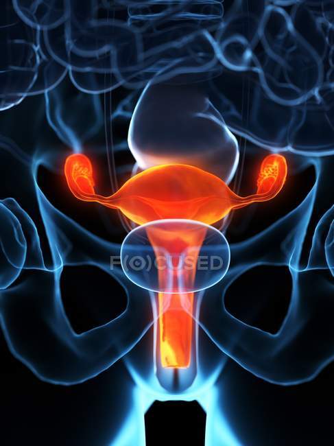 Хвора матка в жіночому організмі, цифрова ілюстрація . — стокове фото