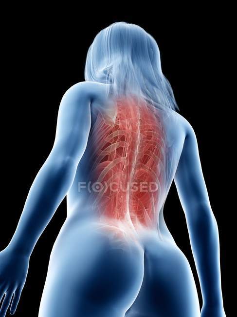 Músculos nas costas femininos, visão de baixo ângulo, ilustração do computador — Fotografia de Stock