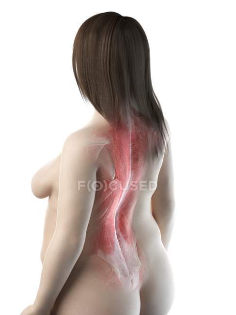 Cuerpo femenino obeso con músculos de la espalda, ilustración por computadora - foto de stock