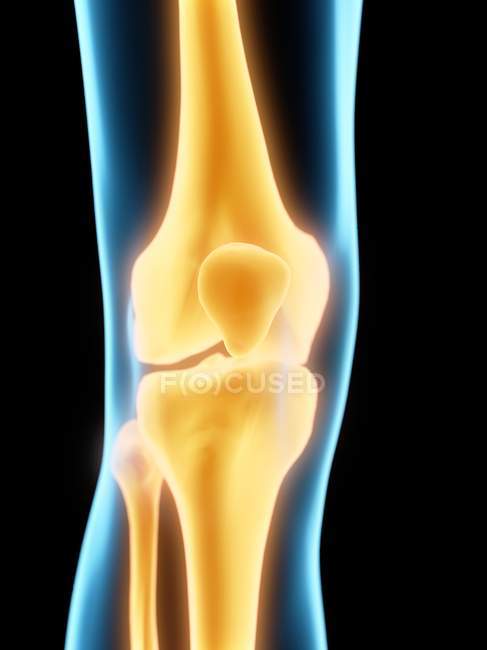 Highlighted rheumatic pain in knee bones, computer illustration. — Stock Photo