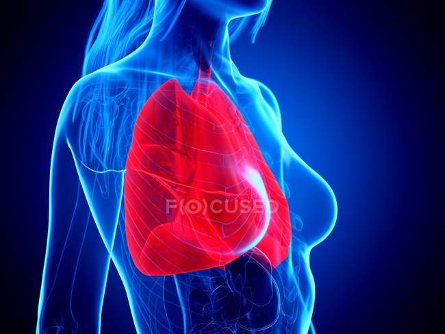 Pulmones de color rojo en silueta del cuerpo femenino sobre fondo azul, ilustración digital
. - foto de stock