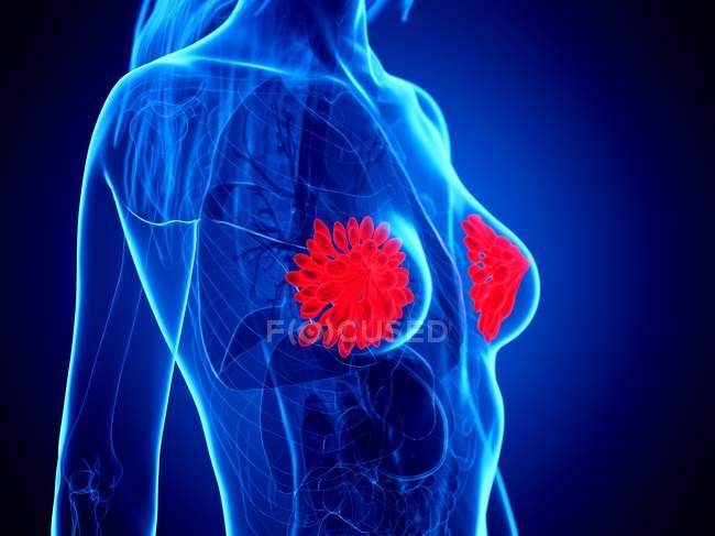 Glandulas mamárias de cor vermelha em corpo abstrato feminino em fundo azul, ilustração digital . — Fotografia de Stock