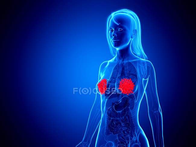 Ghiandole mammarie di colore rosso in corpo femminile astratto su sfondo blu, illustrazione digitale . — Foto stock