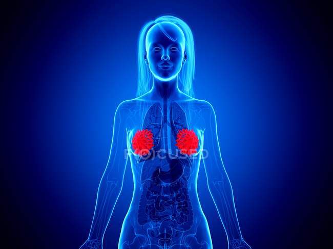 Червоні кольорові молочні залози в жіночому абстрактному тілі на синьому фоні, цифрова ілюстрація . — стокове фото
