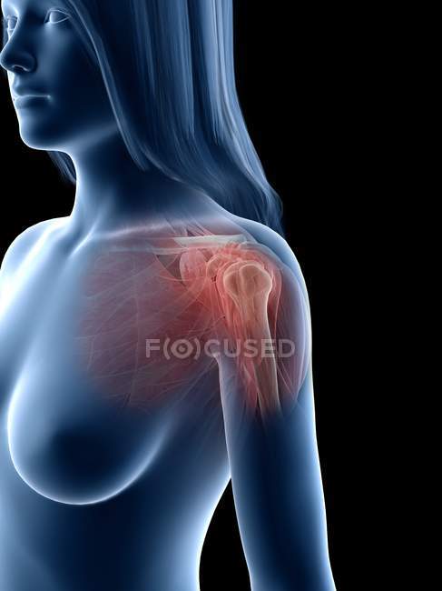 Muscles d'épaule, os et articulations du corps féminin, illustration par ordinateur — Photo de stock