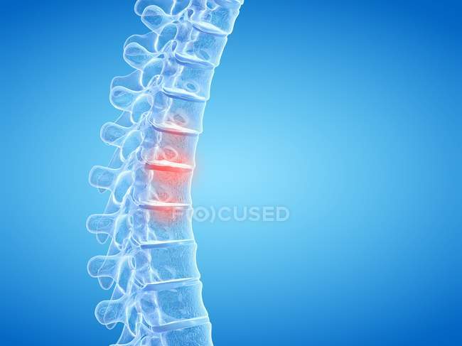Espina dorsal humana que muestra dolor de espalda, ilustración conceptual por computadora . - foto de stock