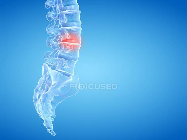 Espina dorsal humana que muestra dolor de espalda, ilustración conceptual por computadora
. — Stock Photo