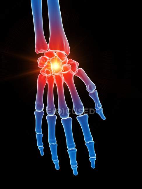 Esqueleto humano con dolor de manos, ilustración conceptual por computadora
. - foto de stock