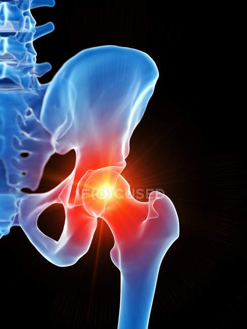 Anatomia umana del dolore all'anca, illustrazione concettuale del computer . — Foto stock