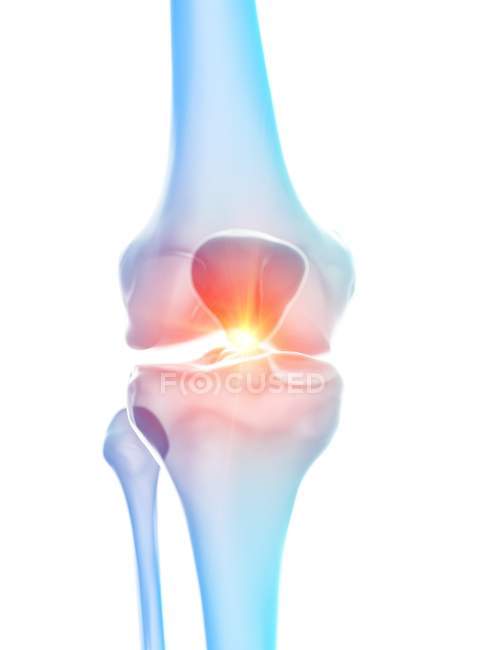 Anatomia umana del dolore al ginocchio, illustrazione concettuale del computer . — Foto stock