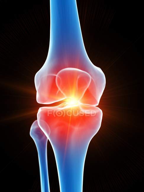 Анатомія людського болю в коліні, концептуальна комп'ютерна ілюстрація . — стокове фото