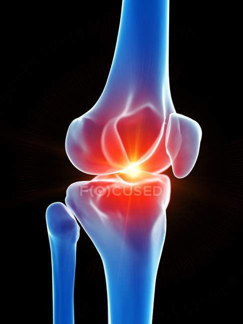 Anatomia humana da dor no joelho, ilustração conceitual do computador . — Fotografia de Stock