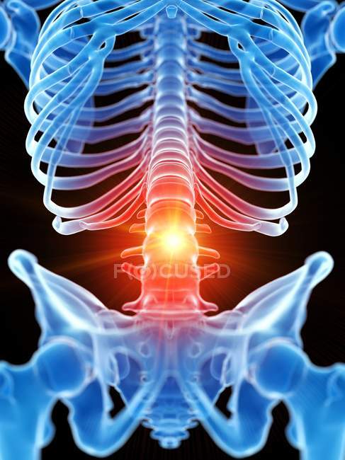 Esqueleto humano con dolor lumbar, ilustración conceptual por ordenador . - foto de stock