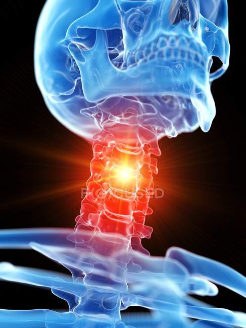 Esqueleto humano con dolor de cuello, ilustración conceptual por computadora . - foto de stock