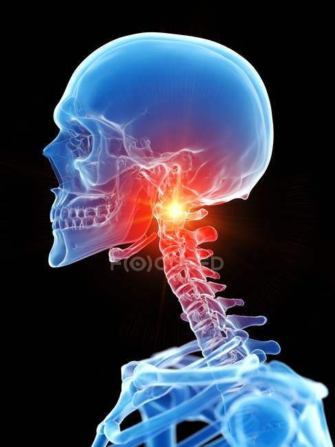 Esqueleto humano con dolor de cuello, ilustración conceptual por computadora
. - foto de stock