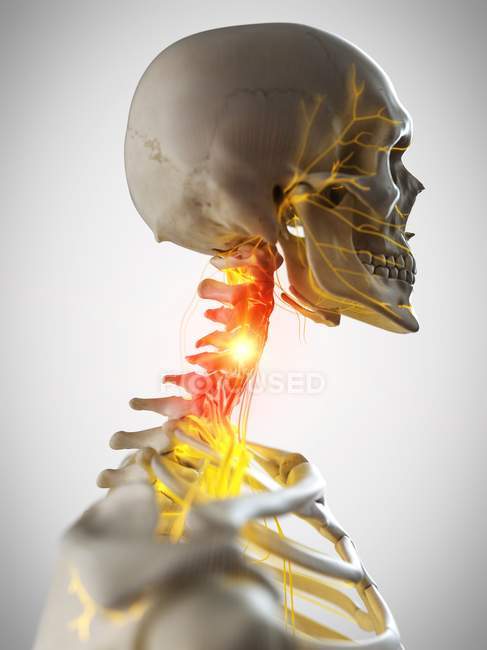Esqueleto humano con dolor de cuello, ilustración conceptual por computadora . - foto de stock