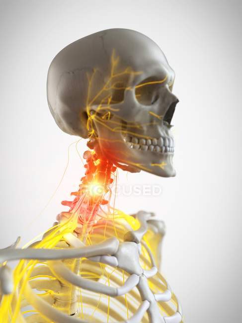 Людський скелет з болем шиї, концептуальний комп'ютерний приклад. — стокове фото