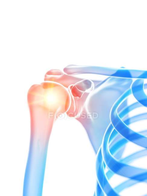 Human skeleton with shoulder pain, conceptual computer illustration. — Stock Photo