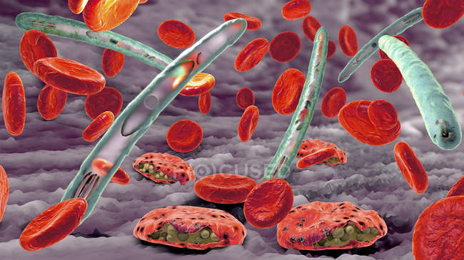Infección por malaria infectando glóbulos rojos, ilustración digital
. - foto de stock