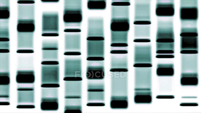 DNA autoradiograph pattern, digital illustration. — Stock Photo