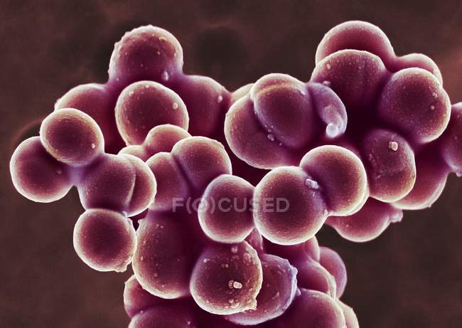 Staphylococcus aureus coccoid bacteria, цветной сканирующий электронный микрограф . — стоковое фото