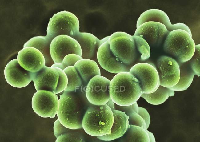 Bactéries coccoïdes Staphylococcus aureus, micrographie électronique à balayage coloré . — Photo de stock