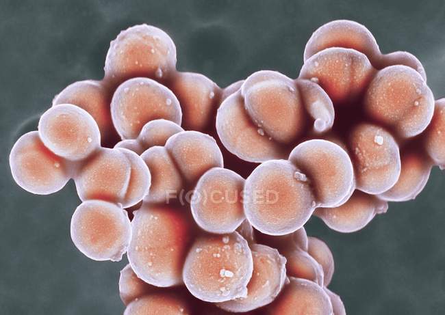 Bacterias coccoides Staphylococcus aureus, micrografía electrónica de barrido de color
. - foto de stock