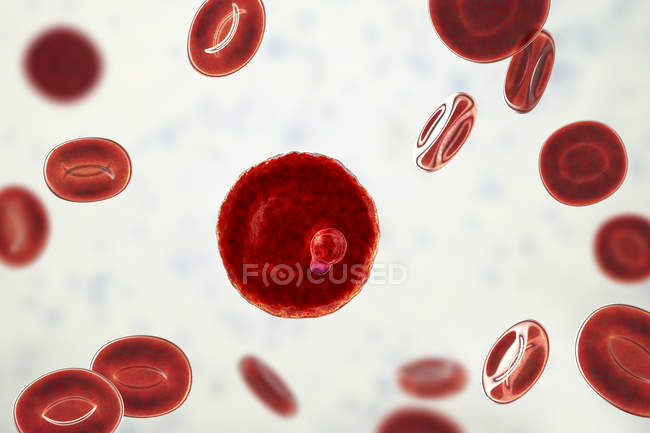 Protozoos de Plasmodium malariae y glóbulos rojos en los vasos sanguíneos, ilustración por ordenador
. - foto de stock