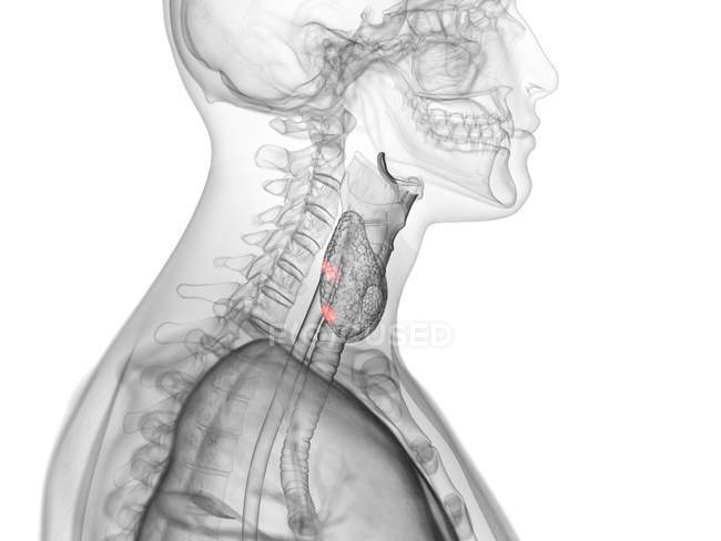 Silhueta masculina abstrata com glândulas paratireoides visíveis, ilustração computacional . — Fotografia de Stock